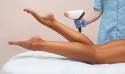 Laser Hair-Removal Sessions at Nu Med Spa - Encino (Up to 88% Off). 12 Options Available.