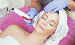 Microneedling Session with Stem Cell Treatment or Laser Genesis Treatment — Claire Skin Clinic (Up to 60% Off)