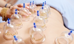 One or Three Cupping Sessions at Rapha Acupuncture (Up to 72% Off)