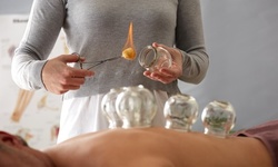 Up to 46% Off on Cupping at Natural Acupuncture & Cupping Center