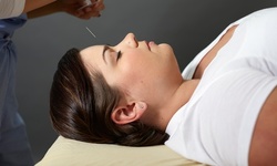 One or Three Acupuncture Treatments at Hwa Ann Wellness (Up to 79% Off)