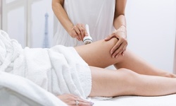 One or Three Ultrasonic Cavitation Treatments at Rose to Beauty (Up to 90% Off)