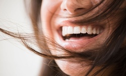 $123.53 for an In-Office Zoom! Teeth-Whitening Treatment at About Glendora Family Dental ($499 Value)