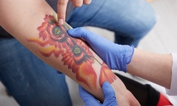 Three PiQo4 Laser Tattoo-Removal Sessions on an Area up to 5 or 12 Square Inches at MS Slim (Up to 87% Off)