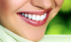 $166 for a Zoom! Teeth-Whitening Treatment with Consultation at Beverly Drive Dental Care ($550 Value)