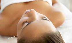 $33.20 for an Acupuncture Treatment at AcuSpa Wellness Center & Spa (Up to $145 Value)