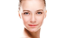 $189 for 50 Units of Dysport at Ageless Center (Up to 40% Off)  